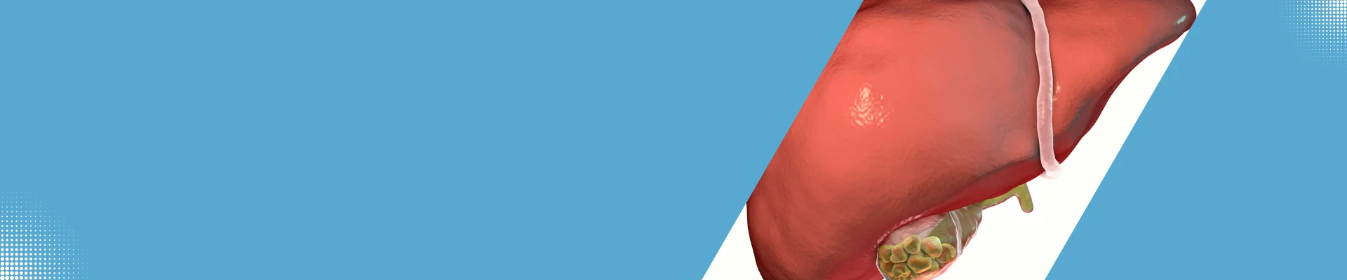 Gall-Bladder-Surgery-image