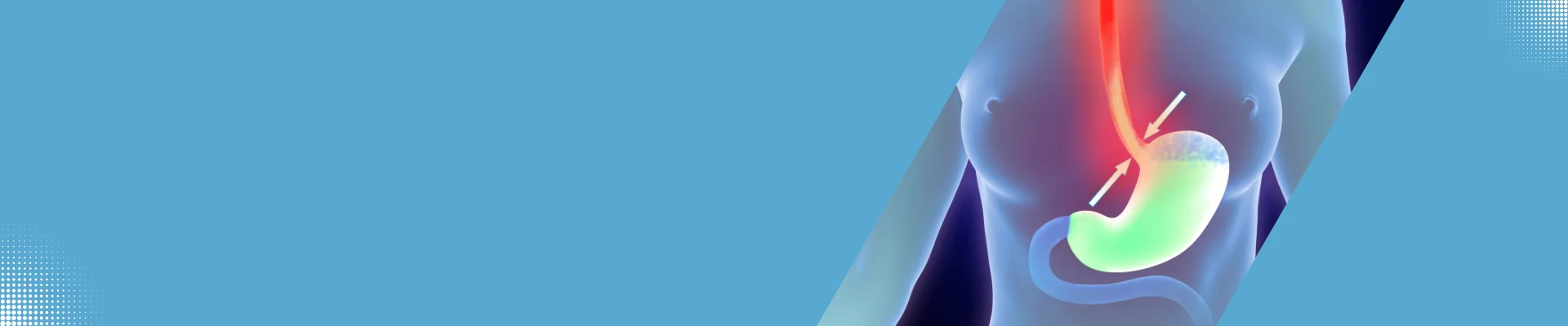 Esophagus-Surgery-image (2)