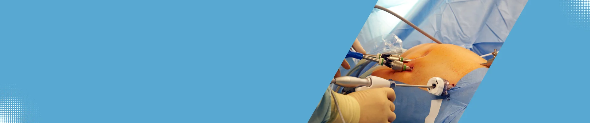 GI-Cancer-Surgery-in-Ahmedabad-Image